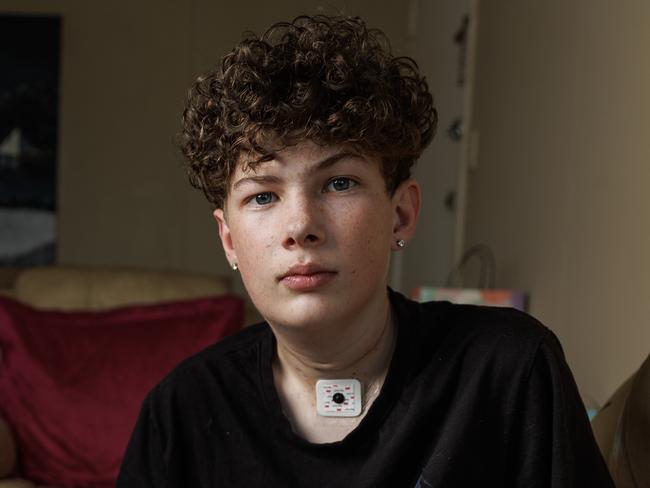 Sixteen year old Aaron Whittington at home in Bracken Ridge after having a a rare Squamous cell Carcinoma removed from his tongue, that has also spread to his lymph nodes on his neck and will now undergo six weeks of Radiotherapy. Picture Lachie Millard