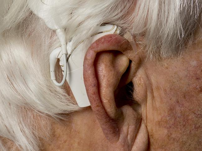 Cochlear holds back some JobKeeper cash