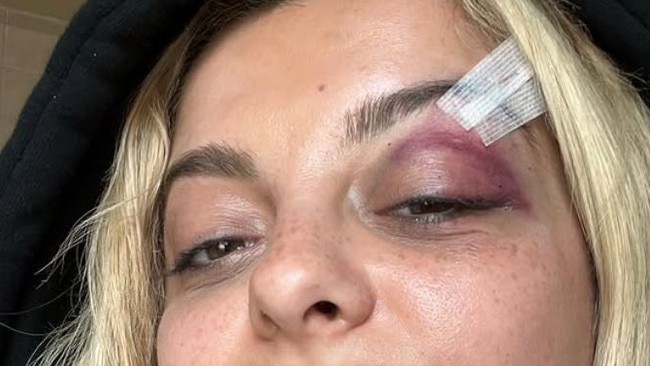 Bebe Rexha had a phone thrown at her while on stage. Picture: Instagram