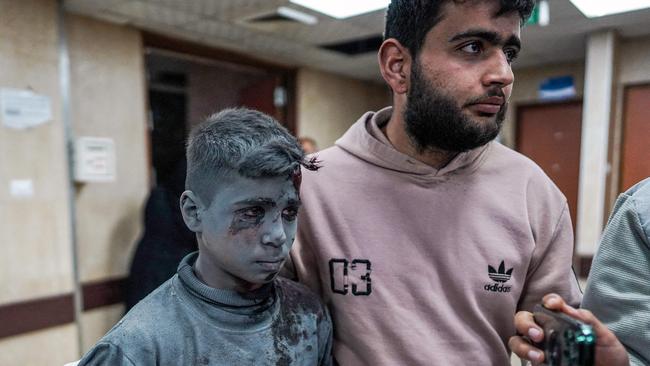 A young Palestinian boy arrives at the Al-Aqsa Martyrs Hospital in Deir al-Balah following Israeli bombardment in the Nuseirat refugee camp . Picture: AFP